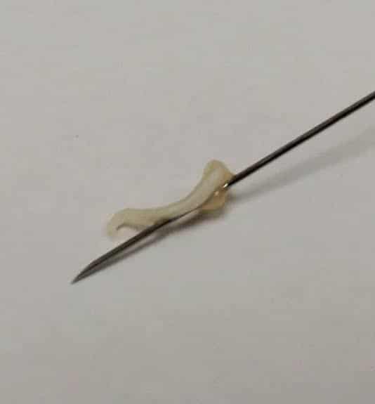 هل يسقط السن بعد سحب العصب