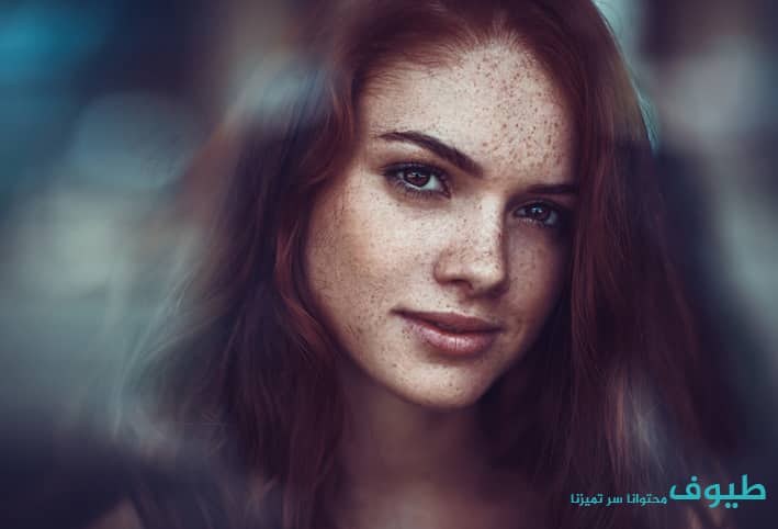 خلطات منزلية لإزالة النمش