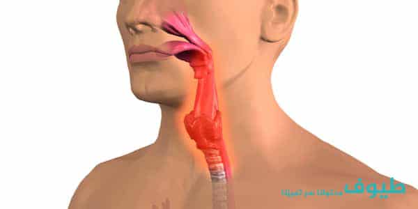جفاف الحلق جفاف الحلق