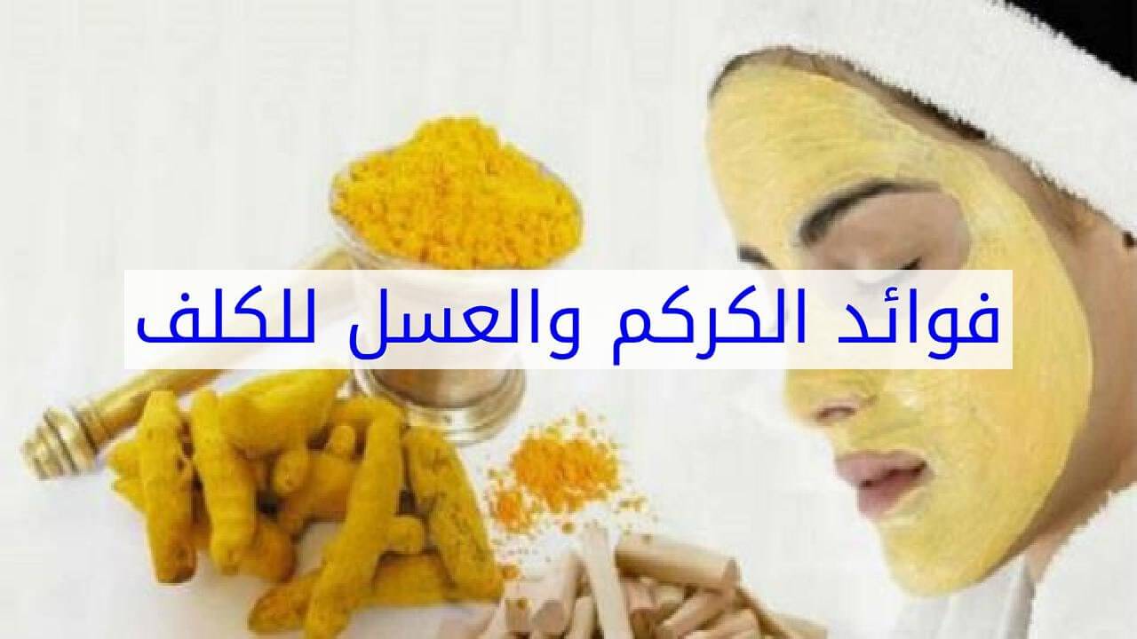 علاج طبيعي للكلف علاج طبيعي للكلف