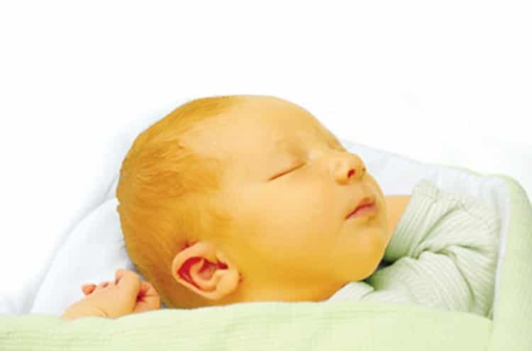 علاج الصفار علاج الصفار