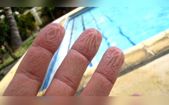 علاج تجعد اليدين من الماء علاج تجعد اليدين من الماء